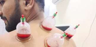 Hijama Therapy – also called cupping therapy removes toxins from the blood through several techniques.