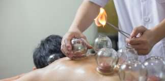 You Should Try Fire Cupping